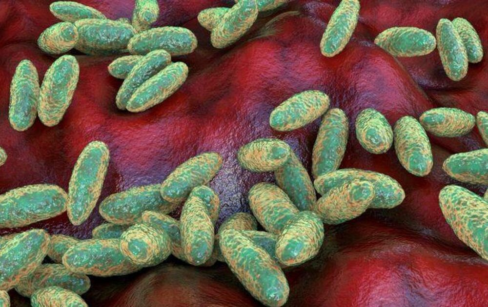 La peste neumónica y su reciente estudio en laboratorio ruso